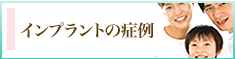 インプラントの実績